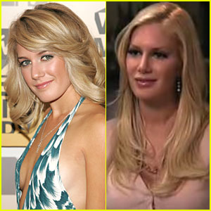 heidi-montag-after-plastic-surgery-interview.jpg